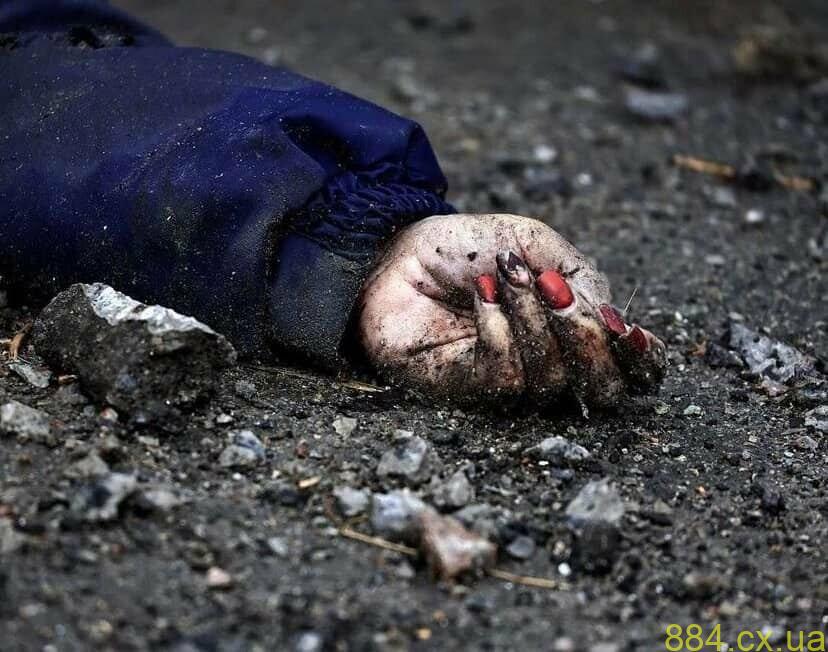 Довелося топити сніг, щоб вижити - Олександр Слобожан, який вижив у оточеній Бучі Довелося топити сніг, щоб вижити - Олександр Слобожан, який вижив у оточеній Бучі