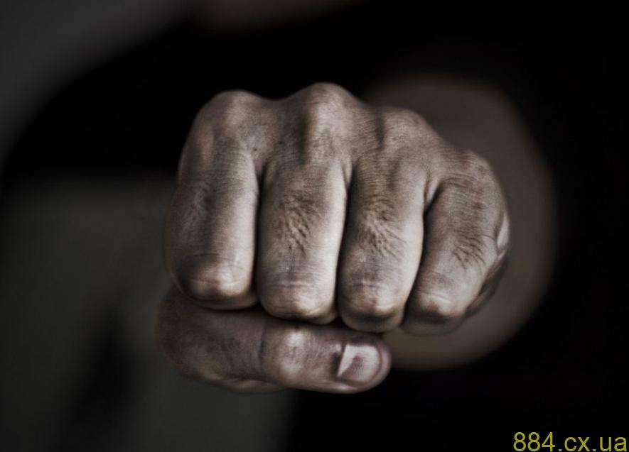 Поліція встановлює обставини травмування жителя Житомирського району Поліція встановлює обставини травмування жителя Житомирського району