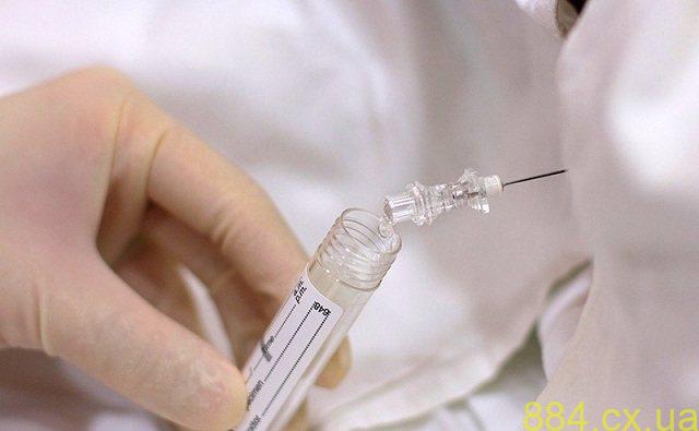 Взятие спинномозговой жидкости Взятие спинномозговой жидкости