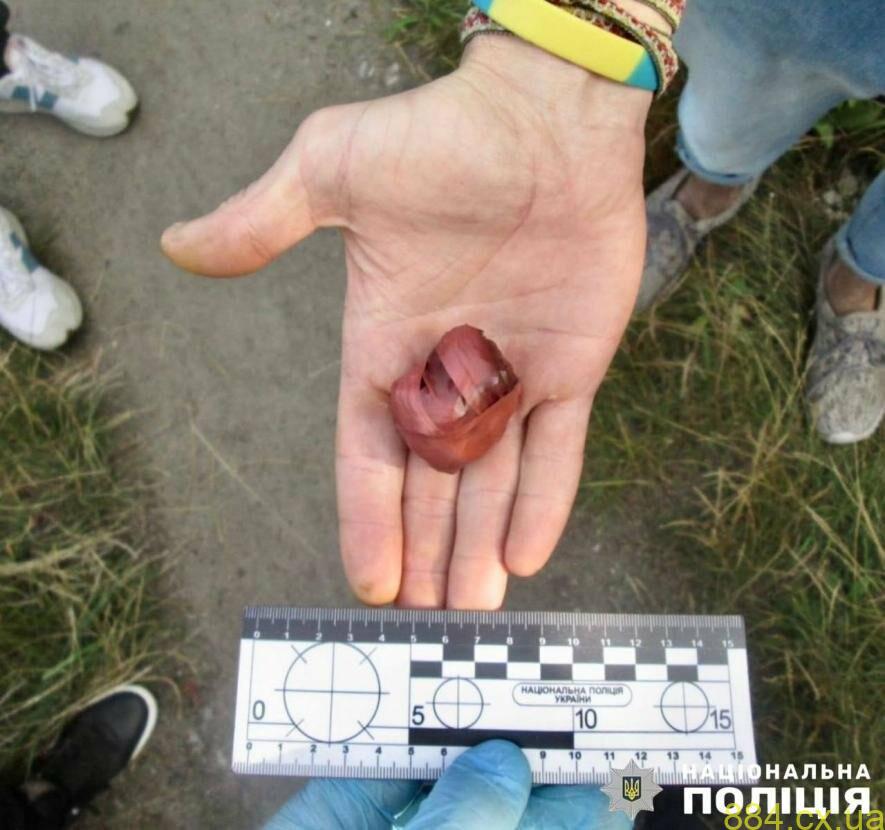 На Житомирщині поліцейські затримали «закладчика» із двома десятками доз психотропних речовин На Житомирщині поліцейські затримали «закладчика» із двома десятками доз психотропних речовин