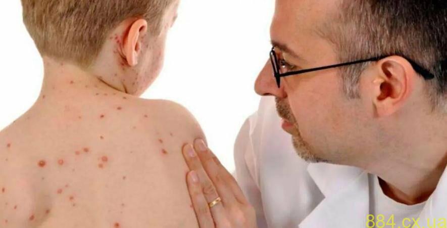 Кір: що має знати кожен Кір: що має знати кожен