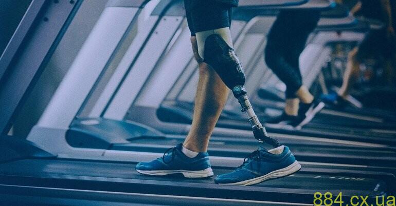 Доступне протезування: За протез платити не потрібно! Доступне протезування: За протез платити не потрібно!