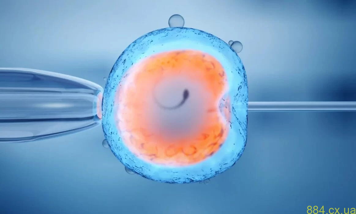 Плюси методу екстракорпорального запліднення Плюси методу екстракорпорального запліднення