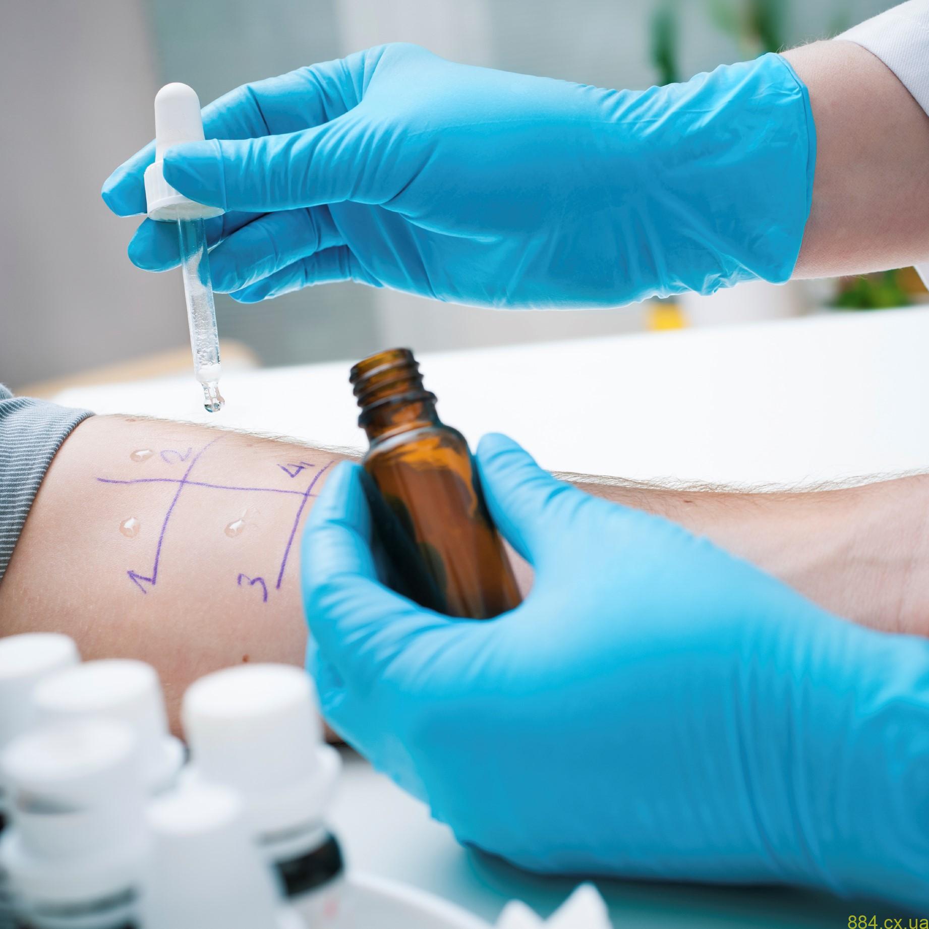 Аллерголог Аллерголог